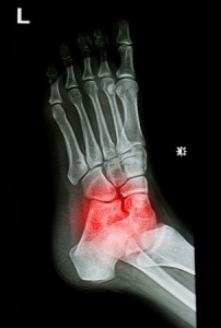 Ankle Image