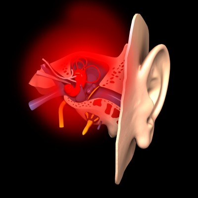 Inner Ear Inflammation